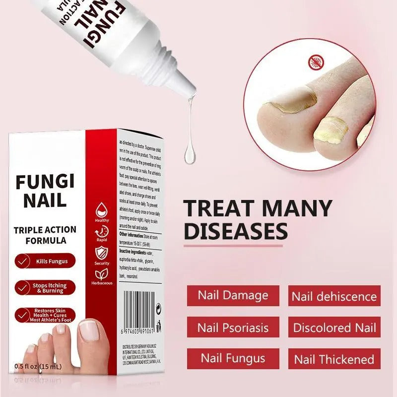 π Toenail Fungus Care Solution β Extra Strength Antifungal Treatment! π-ZZ