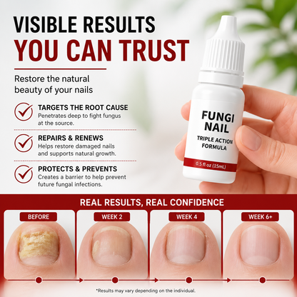 💅 ✨ Extra Strength Toenail Fungus Treatment 🌿🚀 | Triple Action Antifungal Solution for Thick, Damaged & Discolored Nails ⭐ - DG