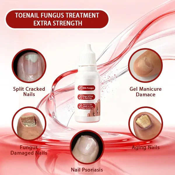 🌟 Fungi Nail – Triple Action Toenail Care Formula 🦶💅 Targets, Repairs & Protects for Healthy, Strong Nails ✨-DG1