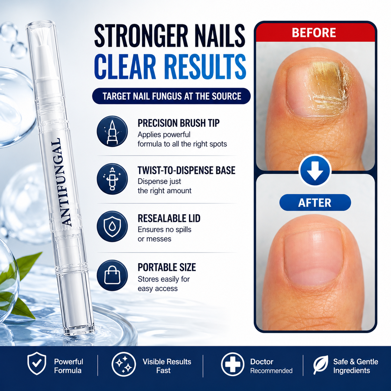 💅 Antifungal Nail & Skin Pen |🌿 Precise Treatment for Nails, Cuticles & Fungal Relief ✨ - DG