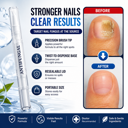 💅 Antifungal Nail & Skin Pen |🌿 Precise Treatment for Nails, Cuticles & Fungal Relief ✨ - DG