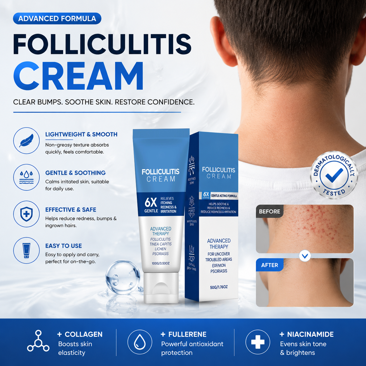 🔥 Folliculitis Relief Cream 🌿 | Soothing Botanical Formula for Scalp, Face & Body Care 100g - DG