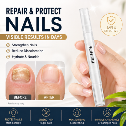 💅 Antifungal Nail & Skin Pen |🌿 Precise Treatment for Nails, Cuticles & Fungal Relief ✨ - DG