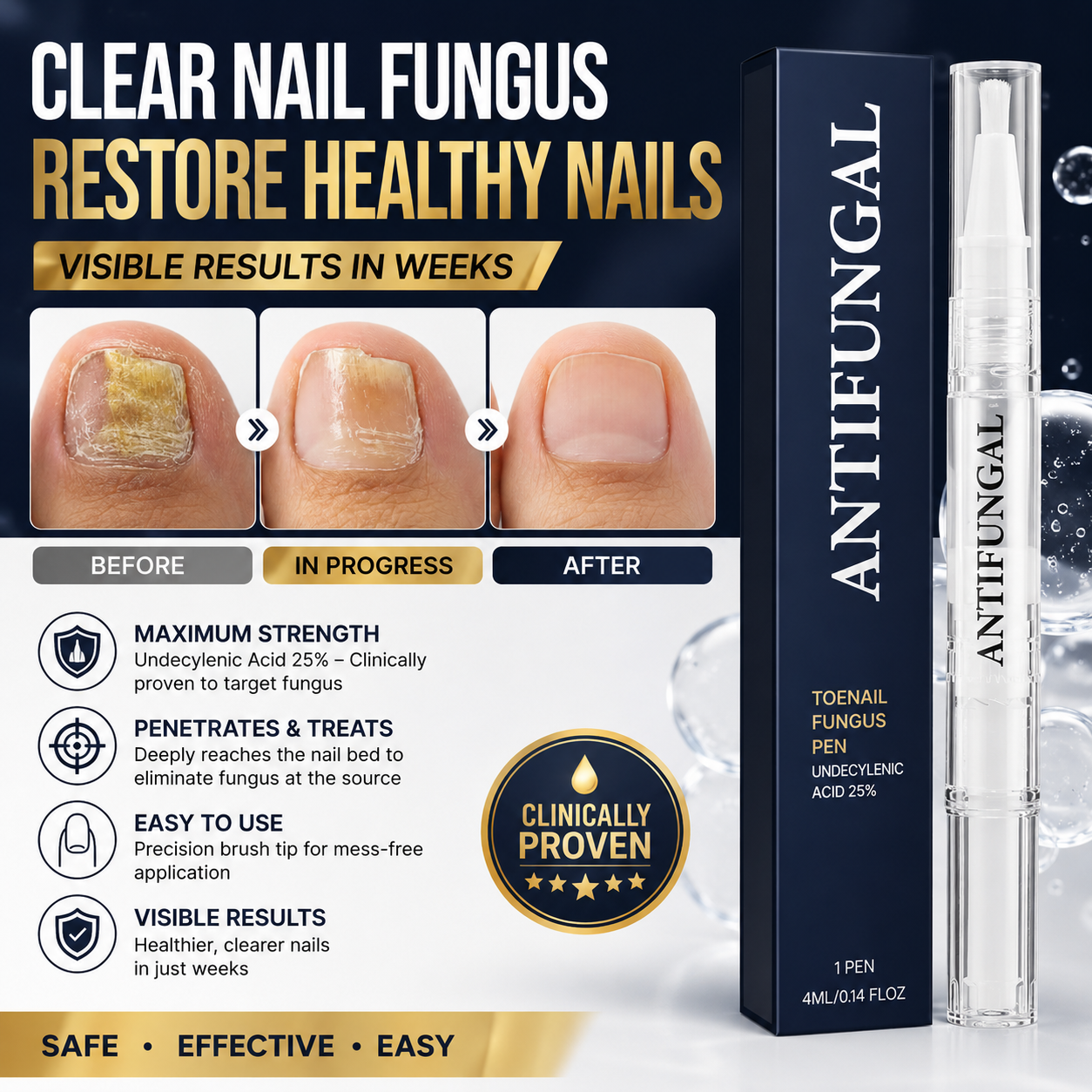 💅 Antifungal Nail & Skin Pen |🌿 Precise Treatment for Nails, Cuticles & Fungal Relief ✨ - DG
