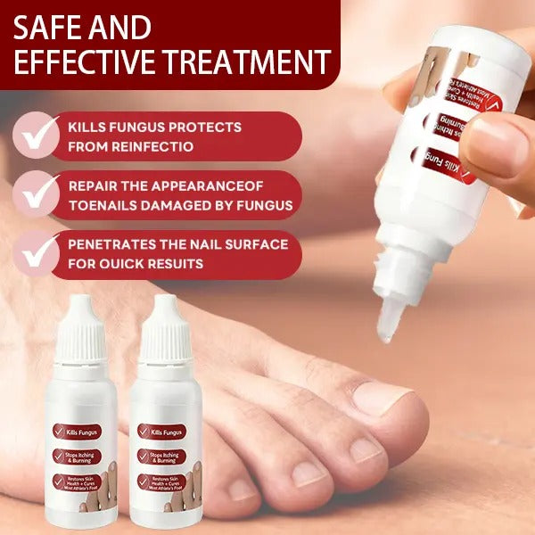 🌟 Toenail Fungus Care Solution – Extra Strength Antifungal Treatment! 🌟-ZZ