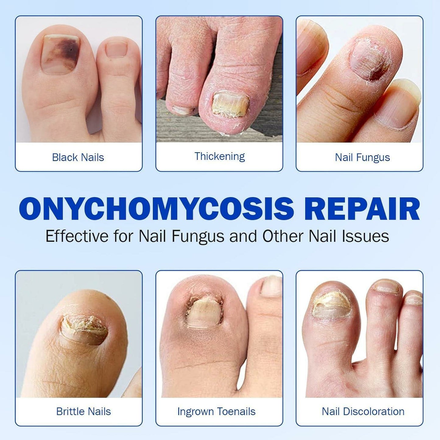 🔥 Nail Care Patches | ✨ Intensive Nail Renewal & Healthy-Looking Nail Support - DG