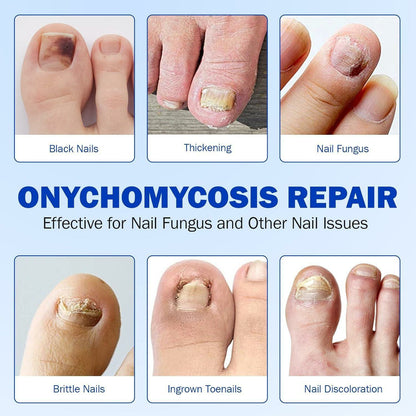 🔥 Nail Care Patches | ✨ Intensive Nail Renewal & Healthy-Looking Nail Support - DG