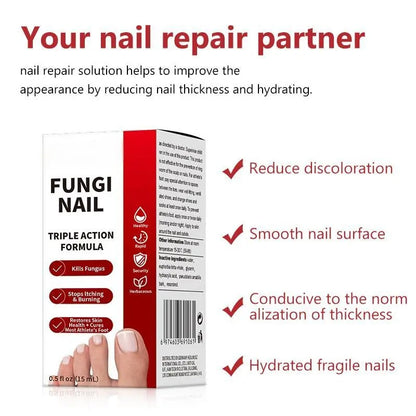 🌟 Toenail Fungus Care Solution – Extra Strength Antifungal Treatment! 🌟-ZZ