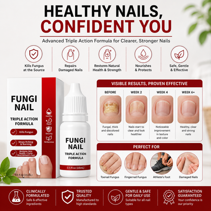 🌟 Toenail Fungus Care Solution – Extra Strength Antifungal Treatment! 🌟-ZZ