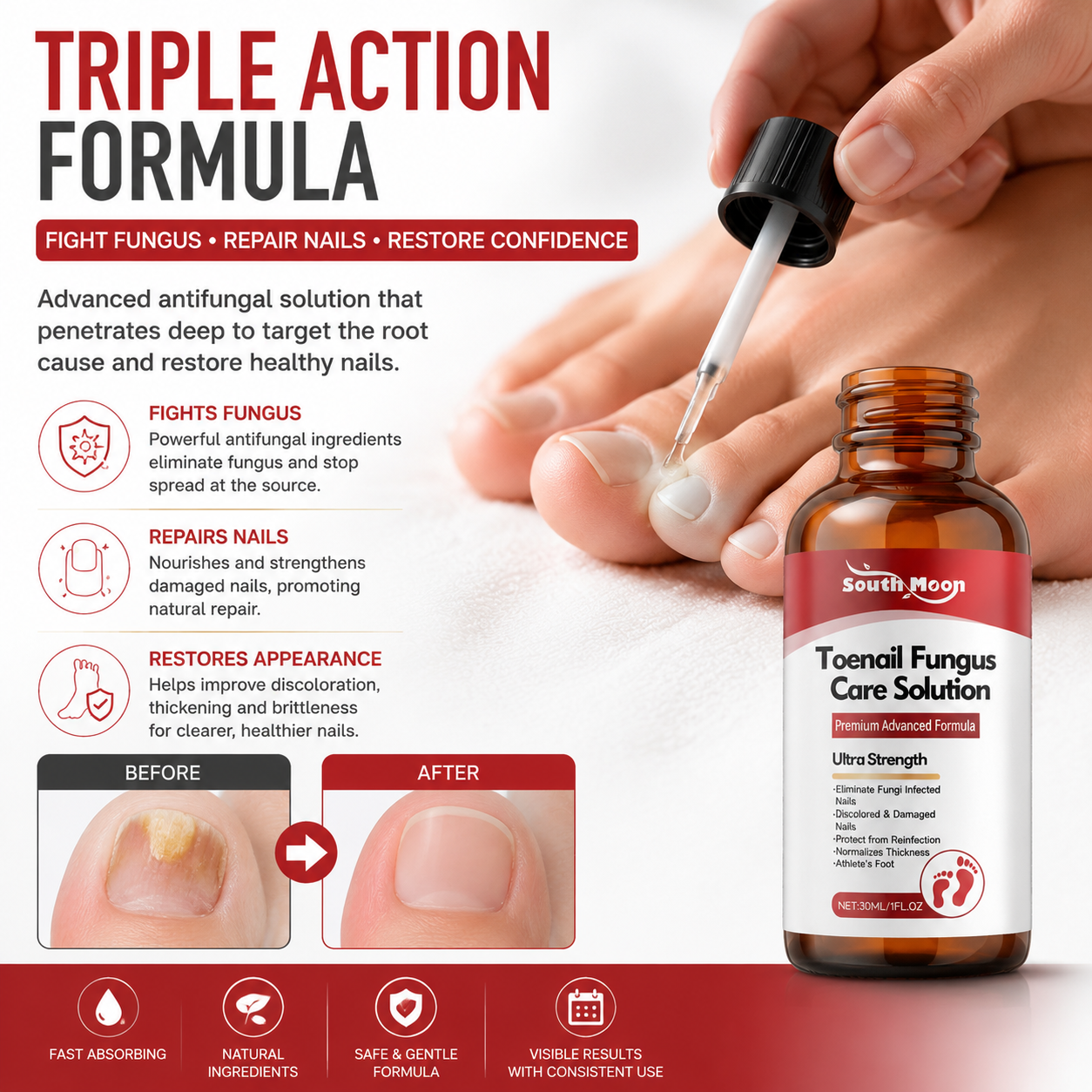 🌟 Toenail Fungus Care Solution – Extra Strength Antifungal Treatment! 🌟-CJY