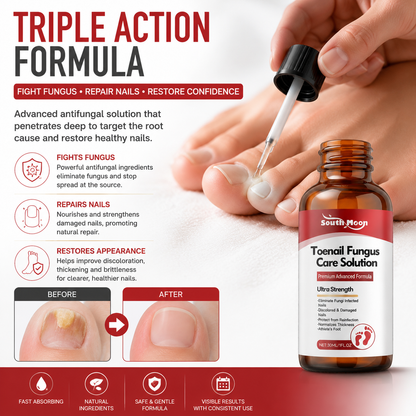 🌟 Toenail Fungus Care Solution – Extra Strength Antifungal Treatment! 🌟-CJY