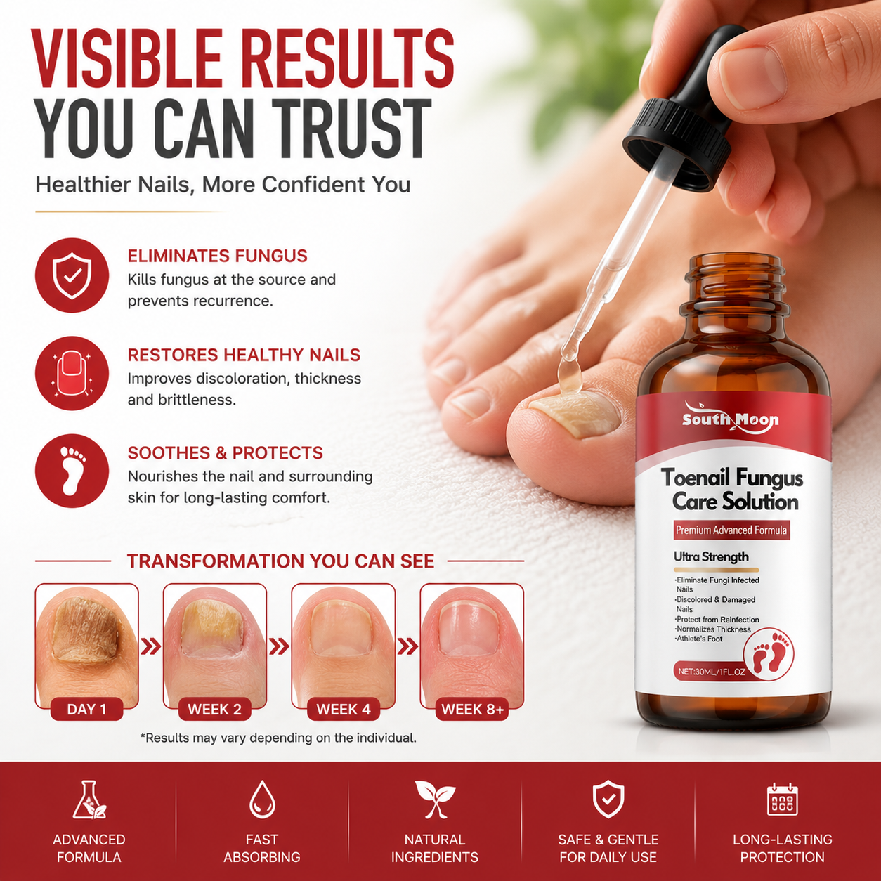 🌟 Toenail Fungus Care Solution – Extra Strength Antifungal Treatment! 🌟-CJY