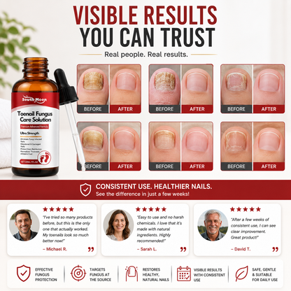 🌟 Toenail Fungus Care Solution – Extra Strength Antifungal Treatment! 🌟-CJY