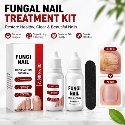 🌟 Fungi Nail – Triple Action Toenail Care Formula 🦶💅 Targets, Repairs & Protects for Healthy, Strong Nails ✨-DG1