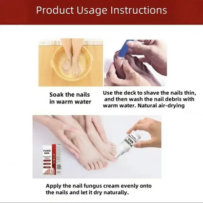 🌟 Toenail Fungus Care Solution – Extra Strength Antifungal Treatment! 🌟-ZZ