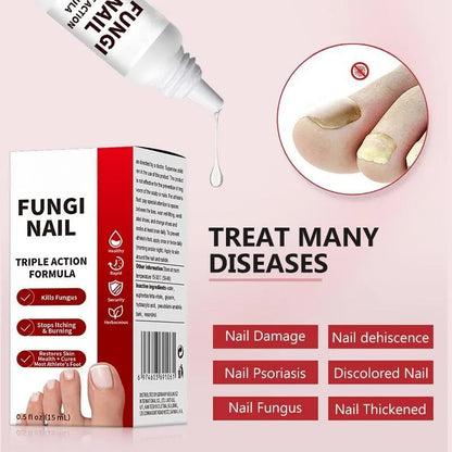 🌟 Toenail Fungus Care Solution – Extra Strength Antifungal Treatment! 🌟-ZZ